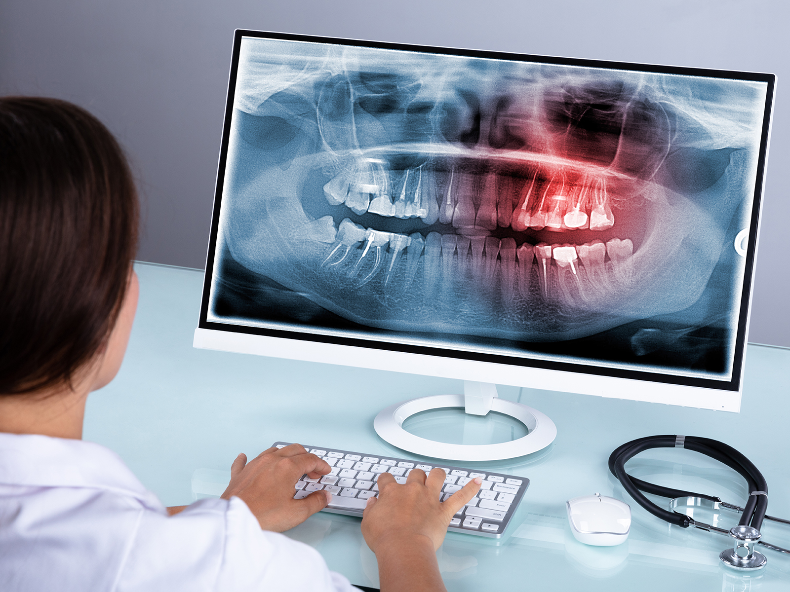 How to Slow Down Bone Loss in Teeth