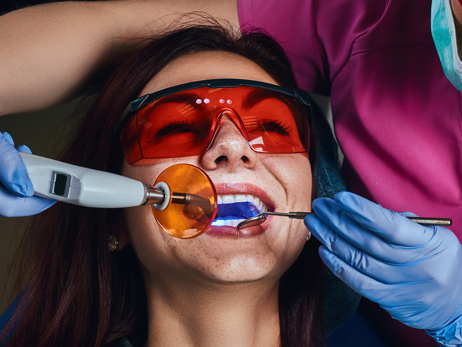 Pros And Cons Of Laser Teeth Whitening