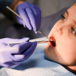 Effectiveness of Dental Sealants In Preventing Cavities