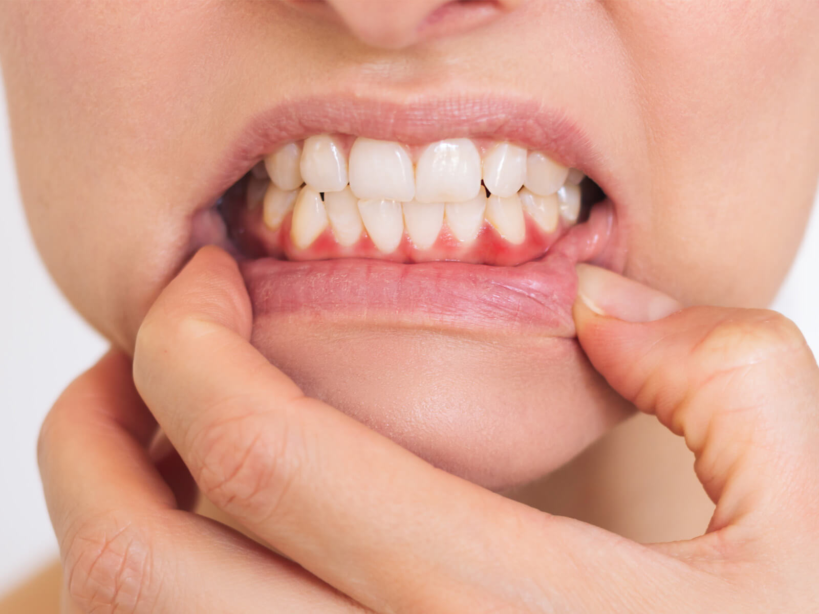 Common Causes of Sore And Inflamed Gums